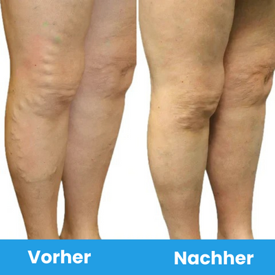 WaveSoothe™ | EMS-Fußmassage-Matte für Entspannung & Aktivierung