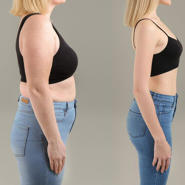 RadianceSculpt™ — Formen Sie Ihren Traumkörper mit müheloser, auffälliger Selbstsicherheit