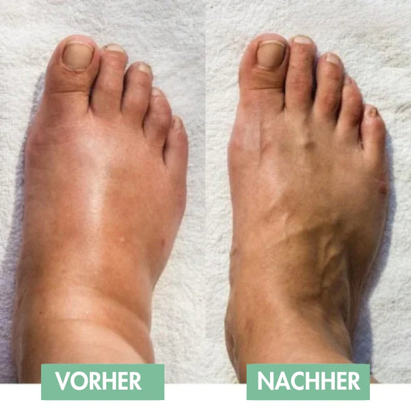 Revivax™ - So lindern Sie Ihre Fußschmerzen sofort