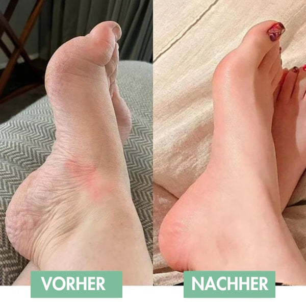 Revivax™ - So lindern Sie Ihre Fußschmerzen sofort