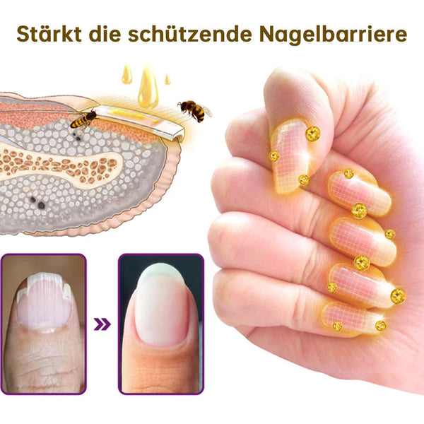 1+1 GRATIS | 🛡️ PilzSchutzschild™ – Sag Nagelpilz den Kampf an!