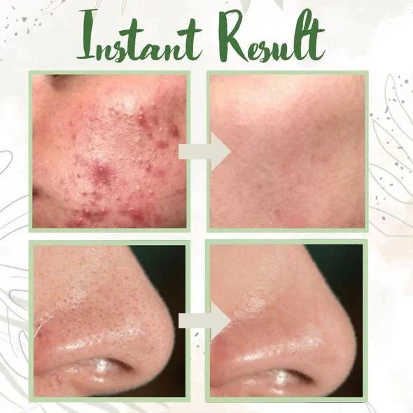 1+1 Gratis | BioBalance Mask™ | Grüner Tee Tiefenreinigungsmaske🍃