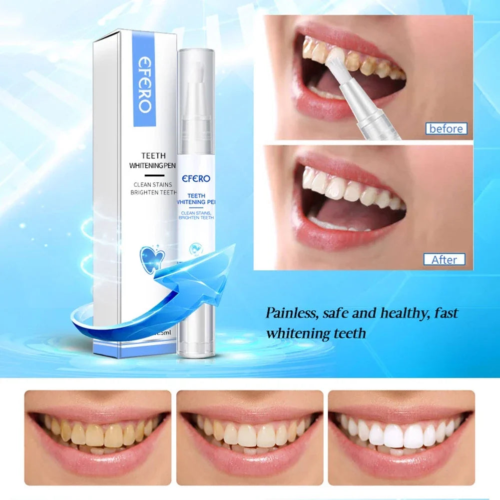 1+1 GRATIS | Brighten™ Zahnaufhellungsstift! ✨