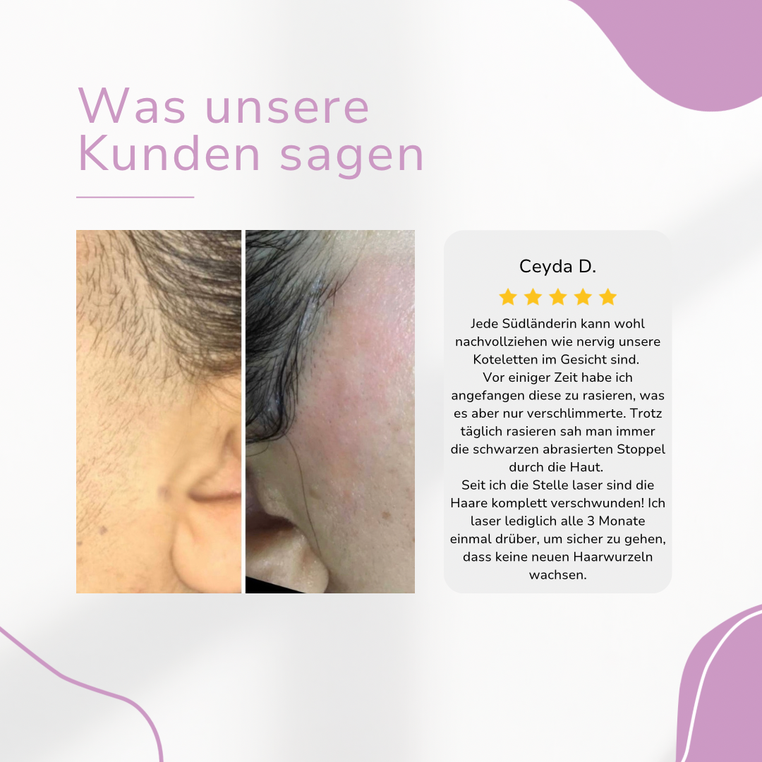 Venzani Ylvis IPL Hair Remover I Die führende Laser-Haarentfernung für Zuhause