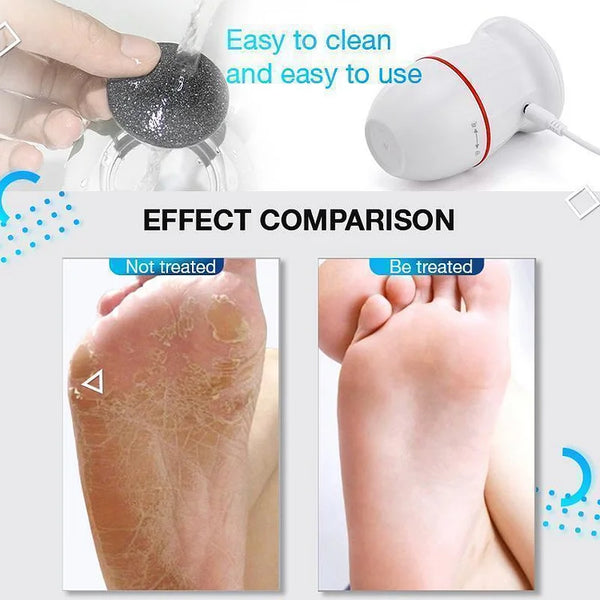 SlikFeet™ - Elektrischer Vakuum-Adsorptions-Fußschleifer