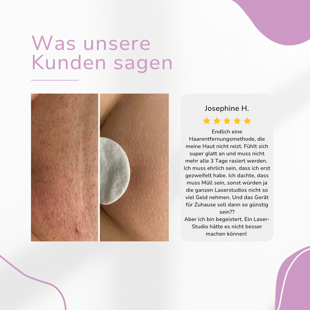 Venzani Ylvis IPL Hair Remover I Die führende Laser-Haarentfernung für Zuhause