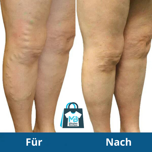 Mooje FootPulse™ | Behandel pijnklachten en stimuleer vetverbranding!