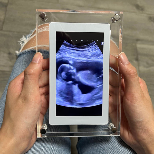 FrameIt™ - Digitaler Fotorahmen für elegante Erinnerungsdarstellung
