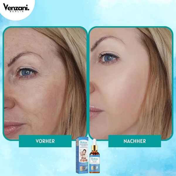 LETZTER TAG 1+1 GRATIS | YouthGlow™ | Botox Antialterung Serum