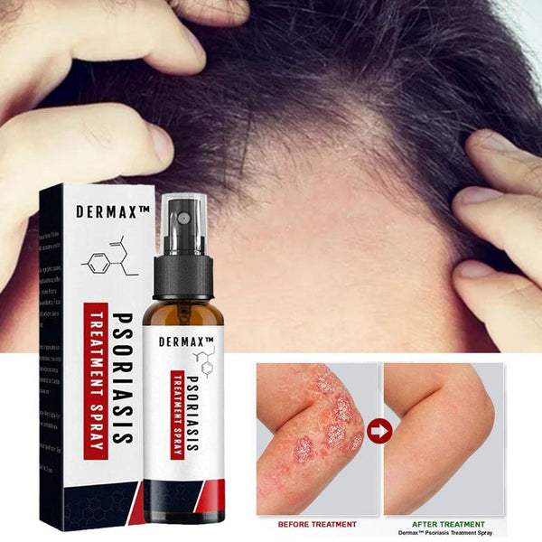 Dermax™ Schuppenflechte-Spray