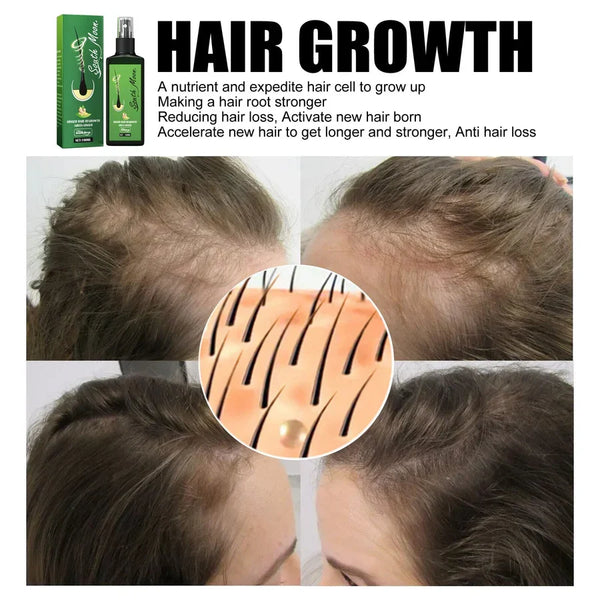 GrowthPlus™ – Nährendes Ingwer-Spray für volleres Haar | NUR HEUTE 1 + 1 GRATIS