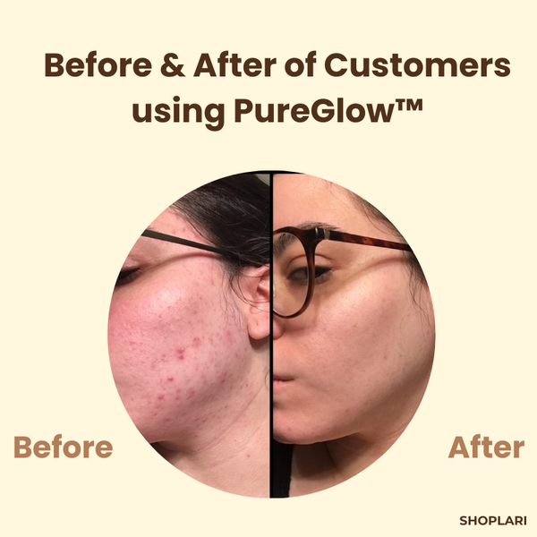 1+1 Gratis PureGlow™ Schwarzer Tee Maske