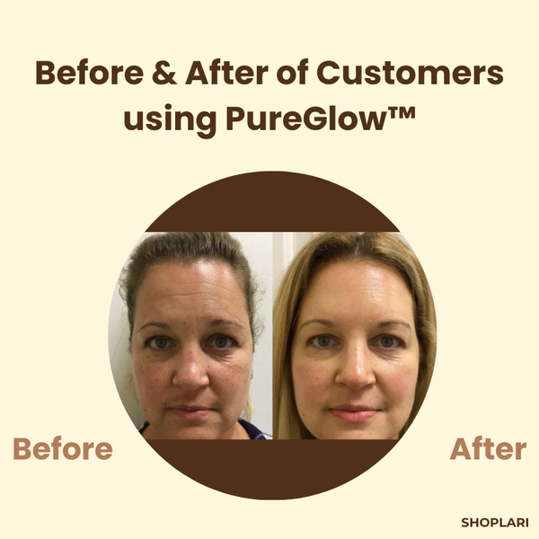 1+1 Gratis PureGlow™ Schwarzer Tee Maske