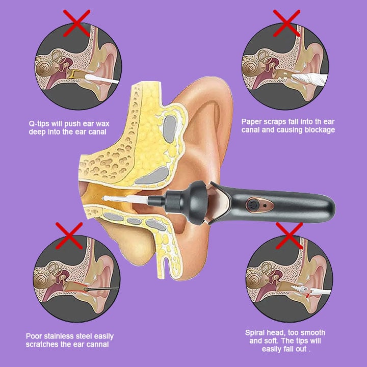 Earlo™ - Schmerzfreie Ohrenschmalzentfernung für die ganze Familie