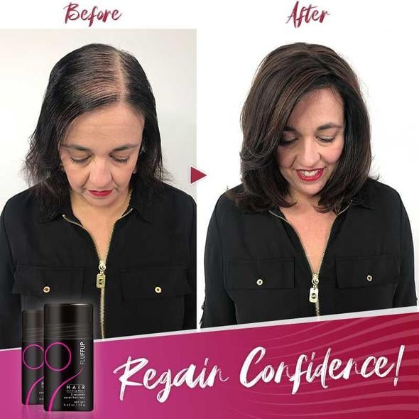 1 + 1 Gratis | HairMagic™ Verhindert kahle Stellen | Letzter Tag Rabatt