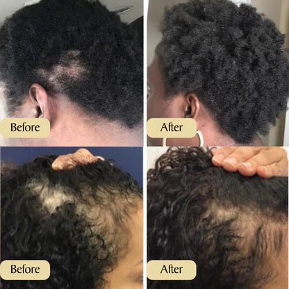 Carvenchy: Ihre natürliche Ölbehandlung für Haarwachstum