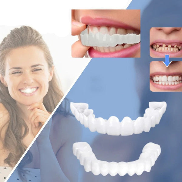 Snap-on Zähne™ - Mit diesen Veneers immer das perfekte Lächeln