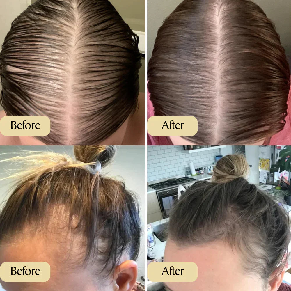 Carvenchy: Ihre natürliche Ölbehandlung für Haarwachstum