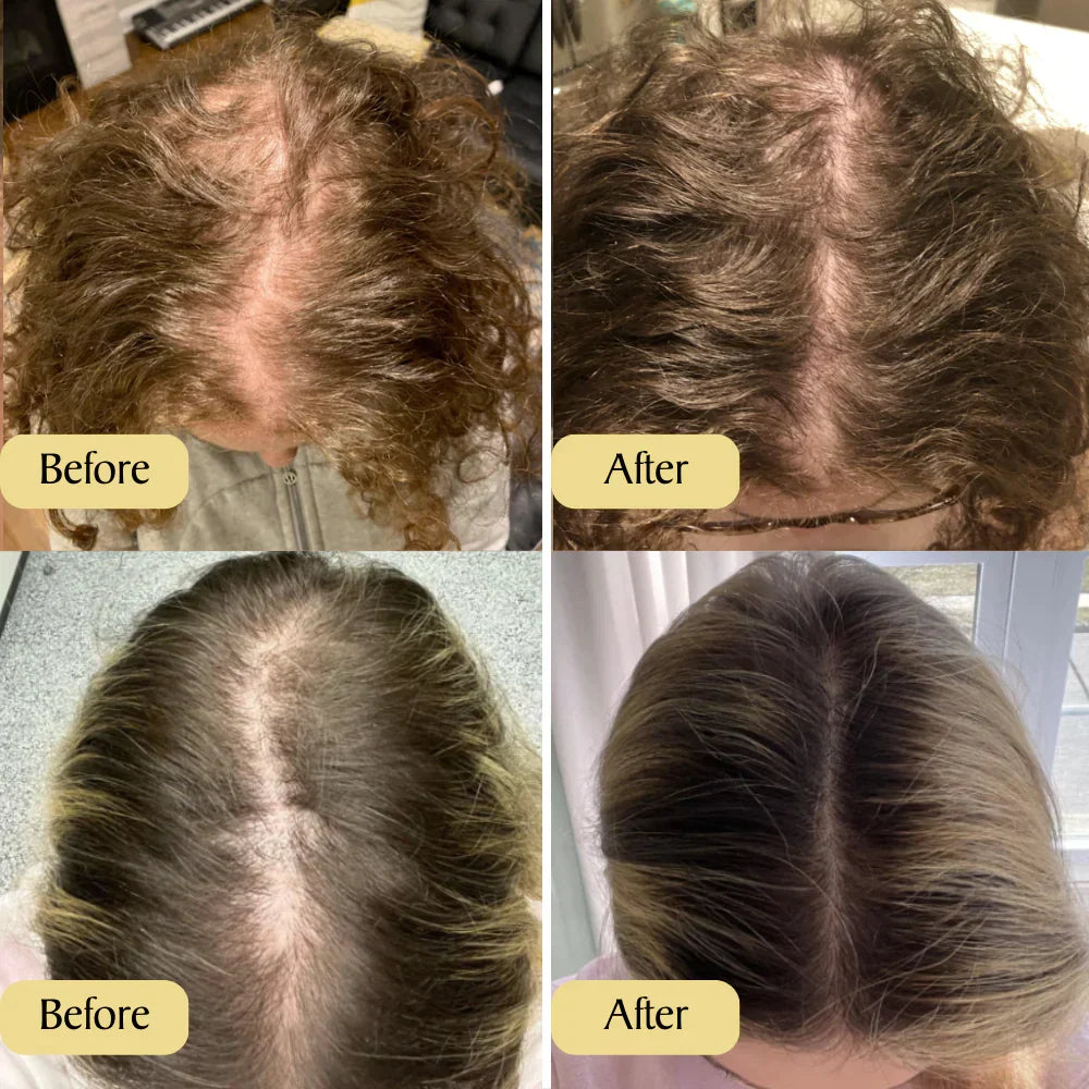 Carvenchy: Ihre natürliche Ölbehandlung für Haarwachstum