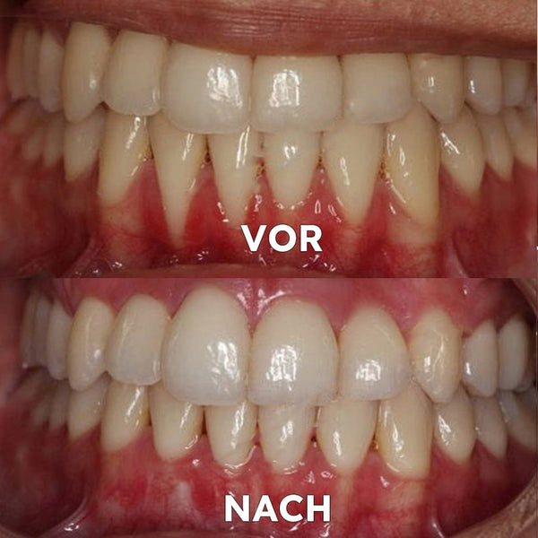Mineralpulver für Zahnpflege | Zähne Stärken & Schützen | SmileSchutz