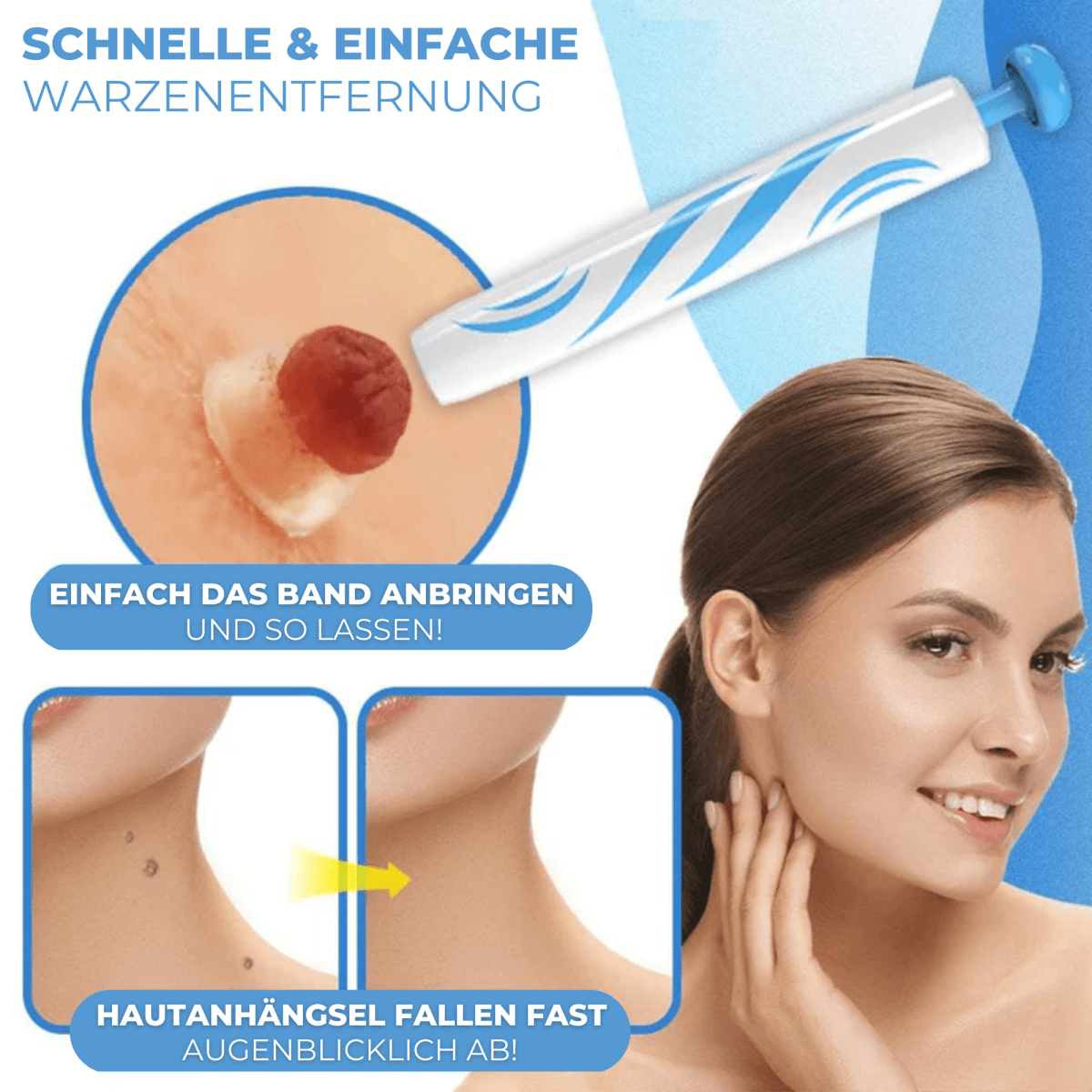 Warzen & Muttermale Entferner Set